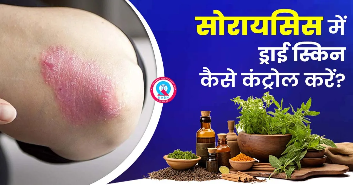 सोरायसिस-में-ड्राई-स्किन-कैसे-कंट्रोल-करें